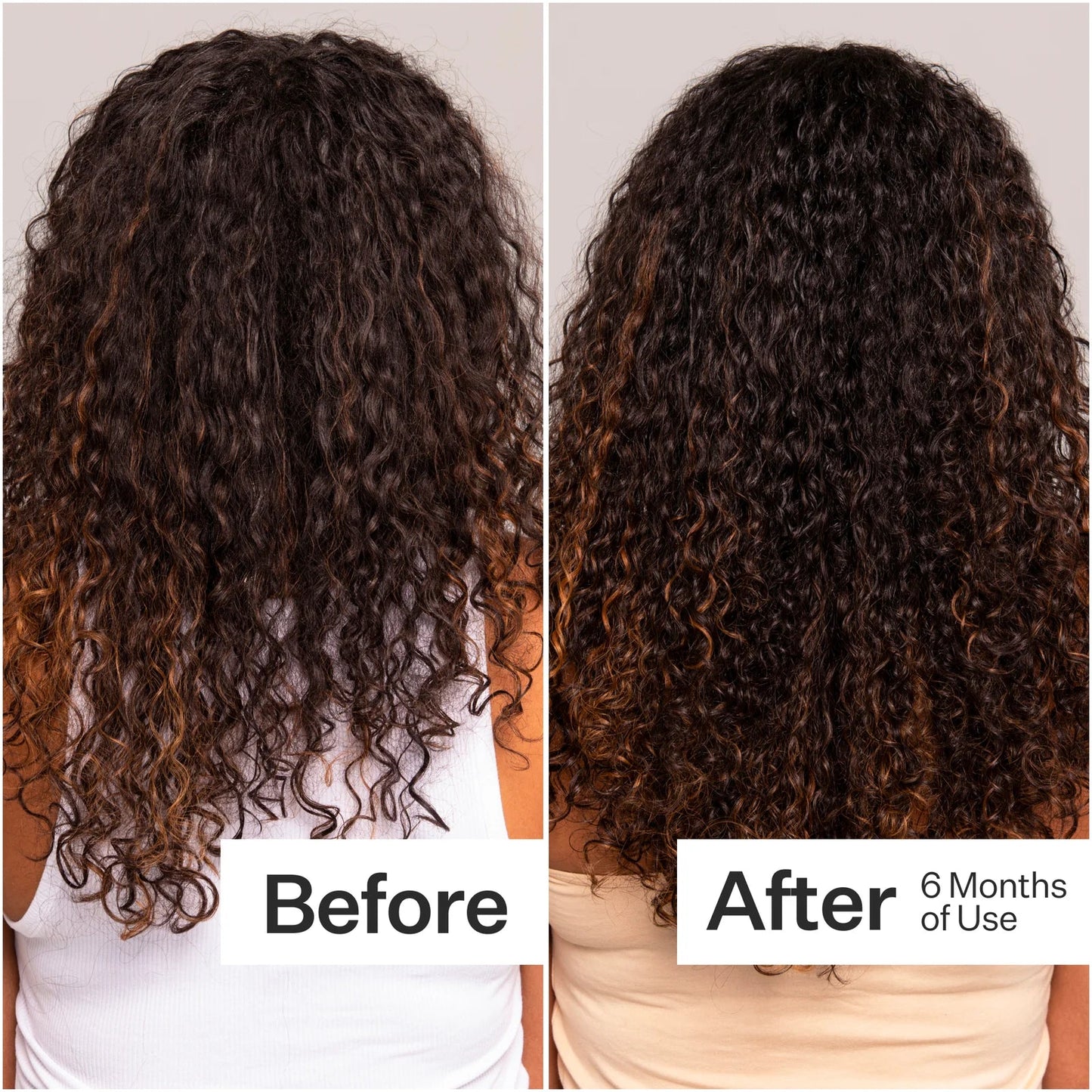 STABILIS ROOTSECURE™ | ONDERSTEUNT HAARVOORWAARDEN DAGELIJKS