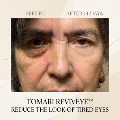 TOMARI REVIVEYE™ | LOOK RESTED EVERY DAY