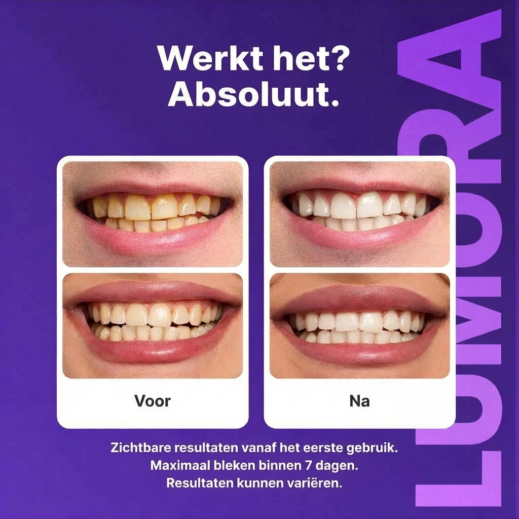 LUMORA™ WHITENING STRIPS | ZICHTBAAR WITTERE TANDEN ZONDER GEVOELIGHEID