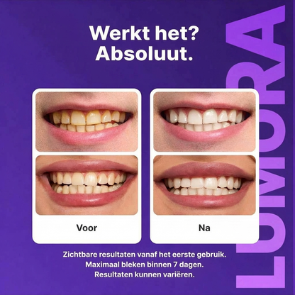 LUMORA™ WHITENING STRIPS | ZICHTBAAR WITTERE TANDEN ZONDER GEVOELIGHEID